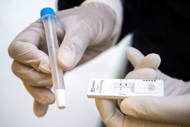 test antígenos
