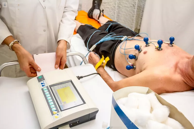 electrocardiograma